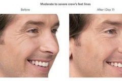 1854794